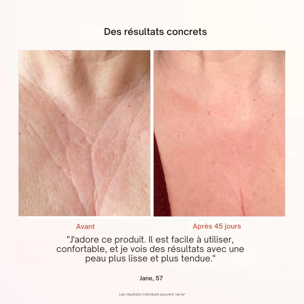 Masque Professionnel de Photothérapie