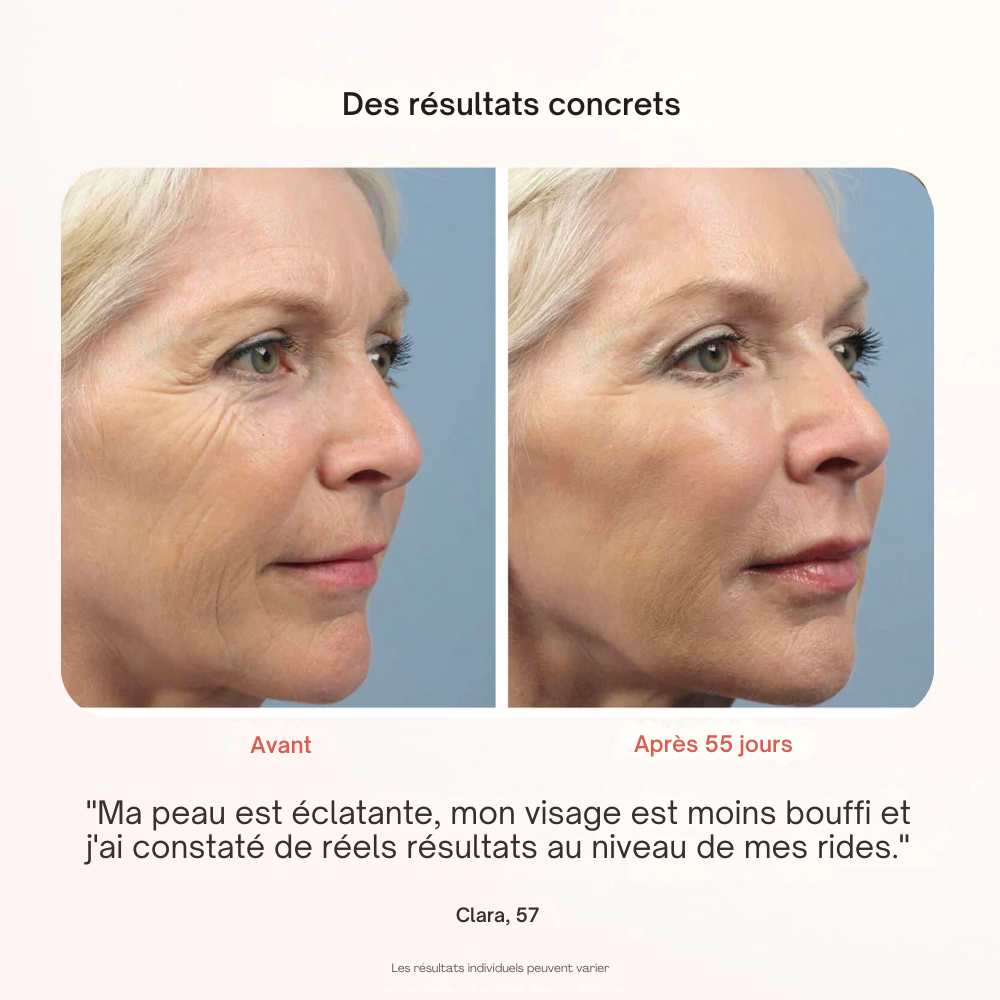 Masque Professionnel de Photothérapie