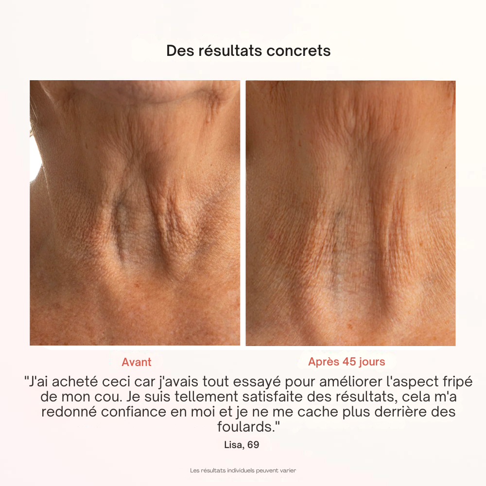 Masque Professionnel de Photothérapie
