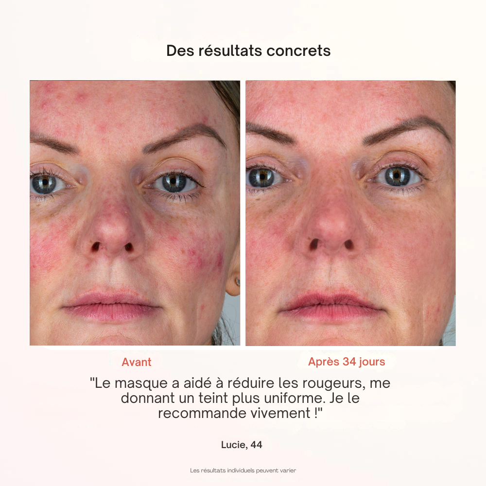 Masque Professionnel de Photothérapie