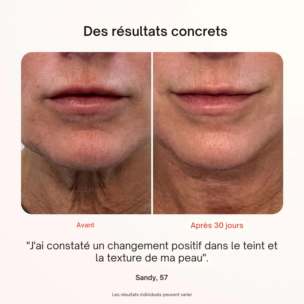 Masque Professionnel de Photothérapie