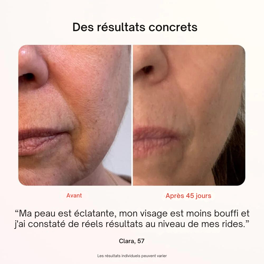 Masque Professionnel de Photothérapie
