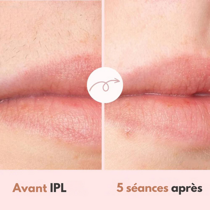 Épilateur Diamond IPL