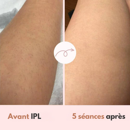 Épilateur Diamond IPL