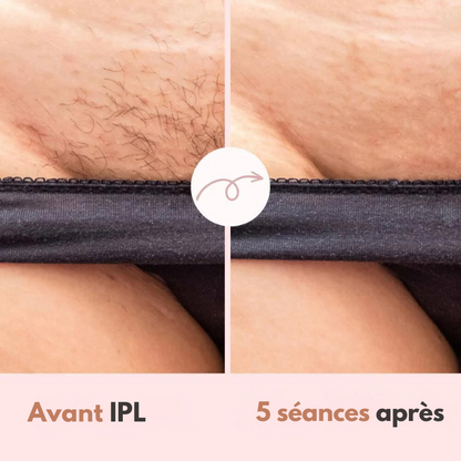 Épilateur Diamond IPL