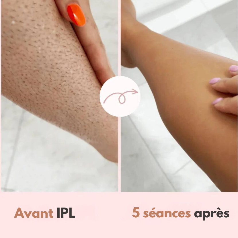 Épilateur Diamond IPL